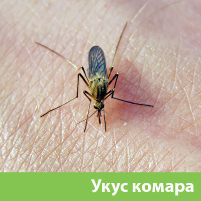 Укусы комаров в Бердске